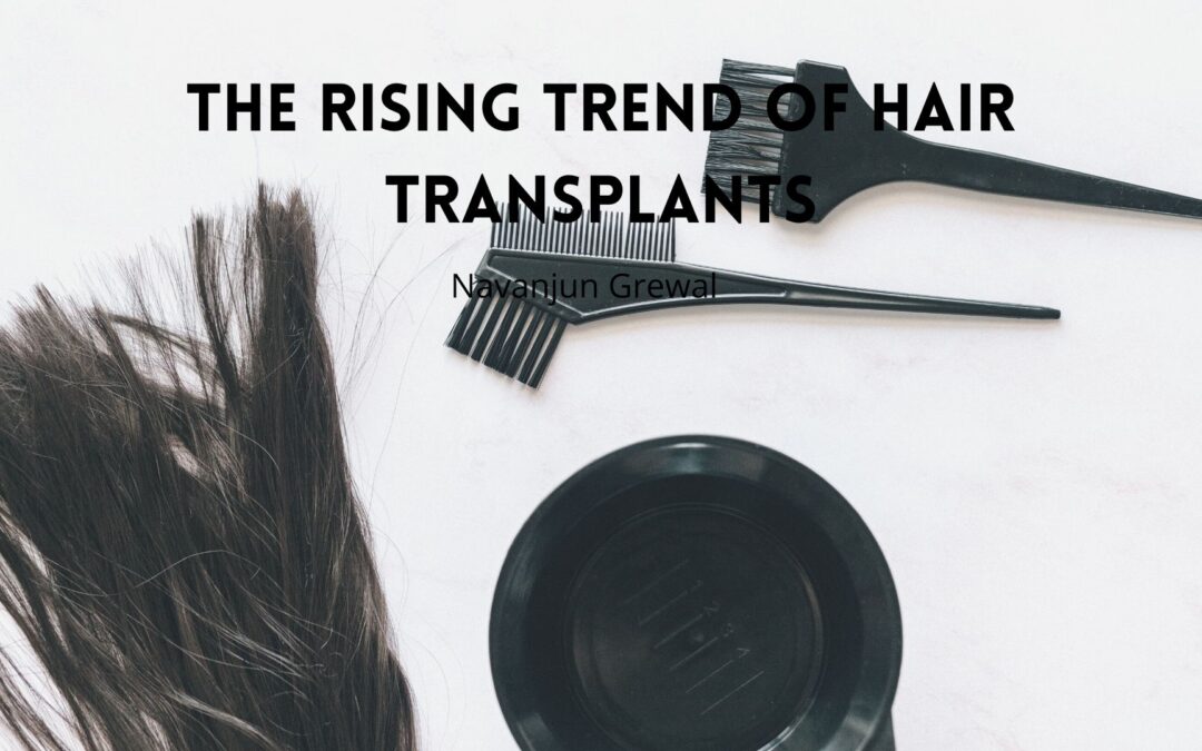 The Rising Trend of Hair Transplants