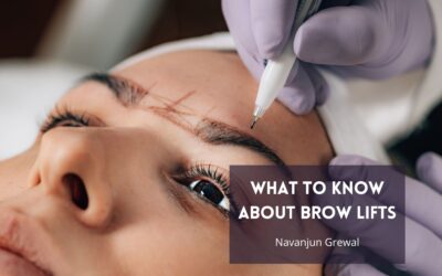 What to Know About Brow Lifts